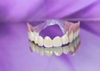 proteza zębowa