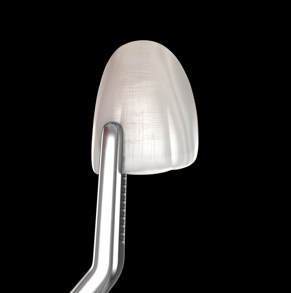 licowki-stomatologia-estetyczna licówki