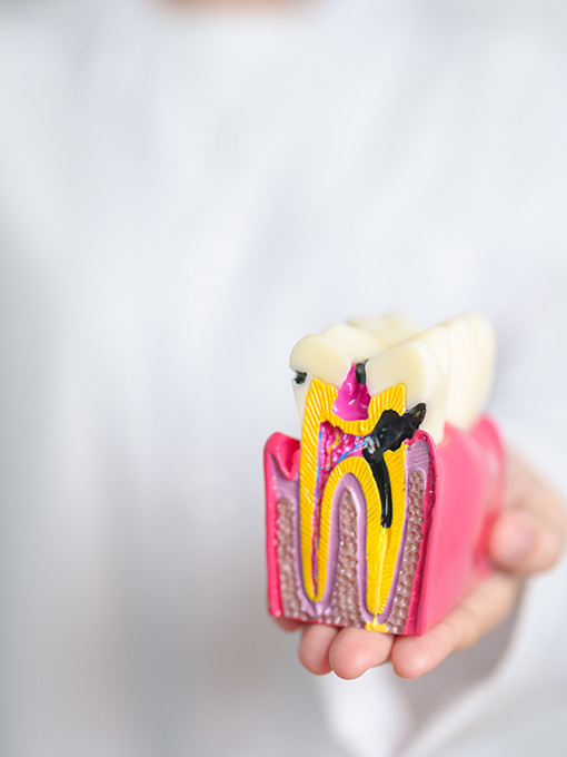 Dentist with tooth Anatomy model. Oral Teeth decay and disease, model koron