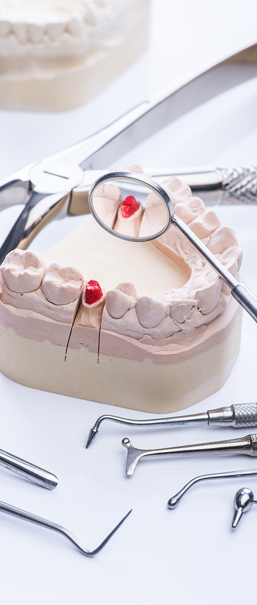 Teeth mold and basic dental tools on white table pokaz koron zębowych