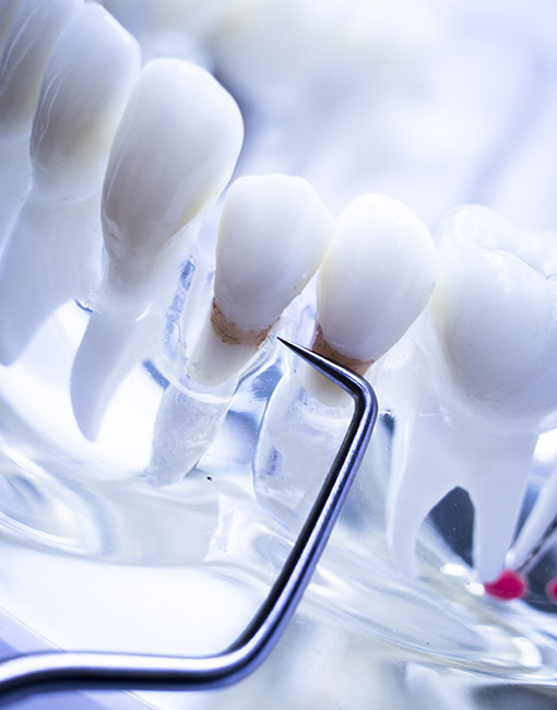 pokaz koron zębowych